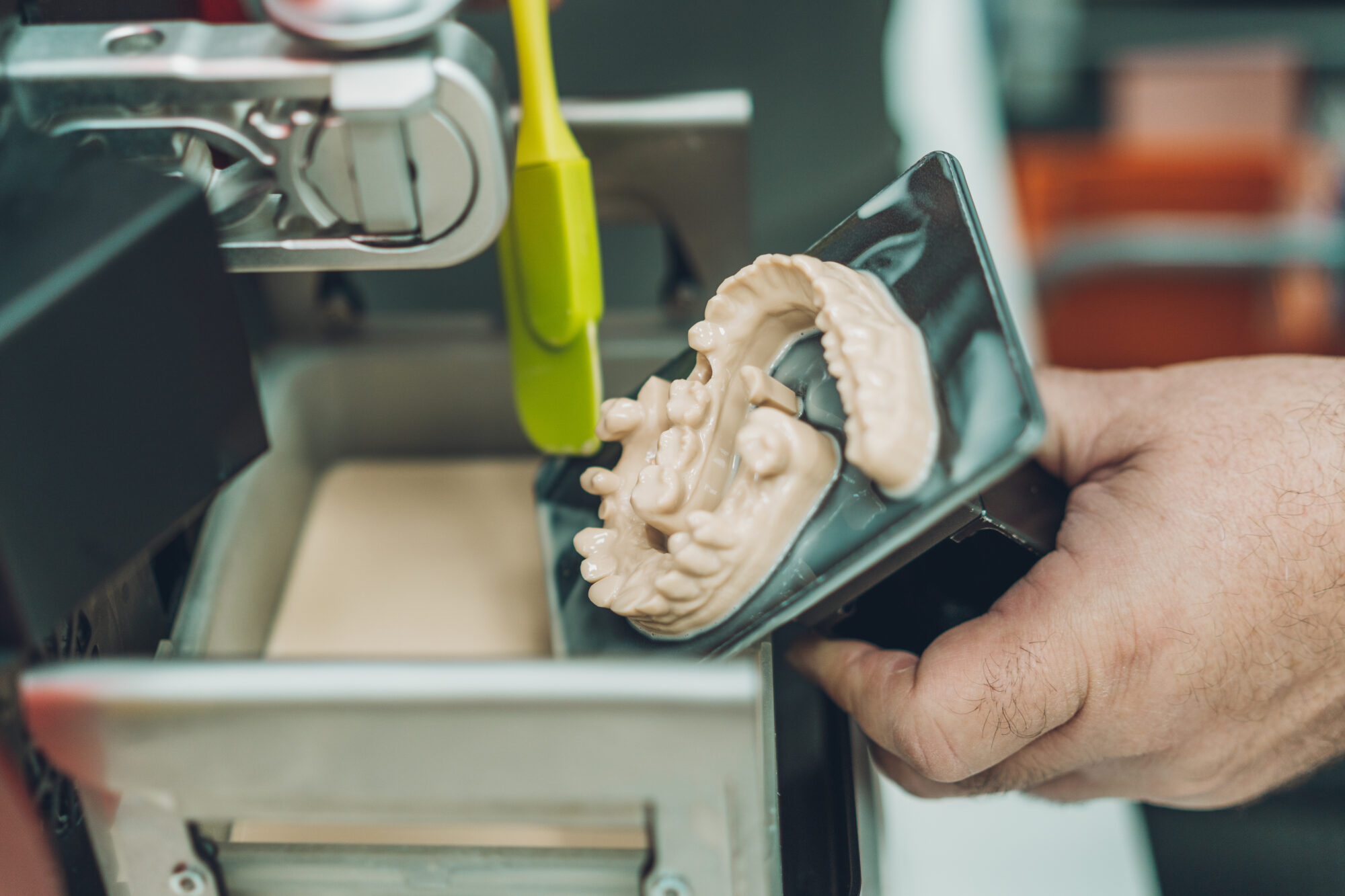 Close-up view of a man using a spatula to collect leftover resin from a 3D dental printer in a laboratory